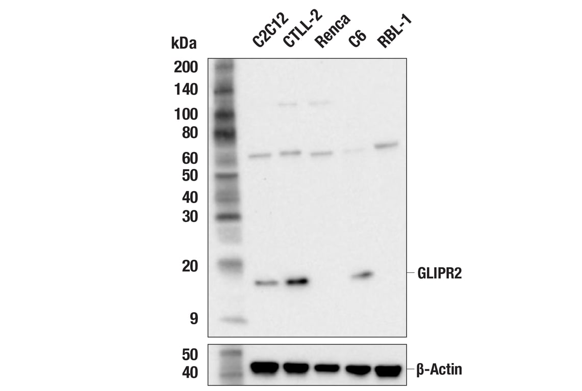Western Blotting Image 2: GLIPR2 (F7H7V) Rabbit mAb