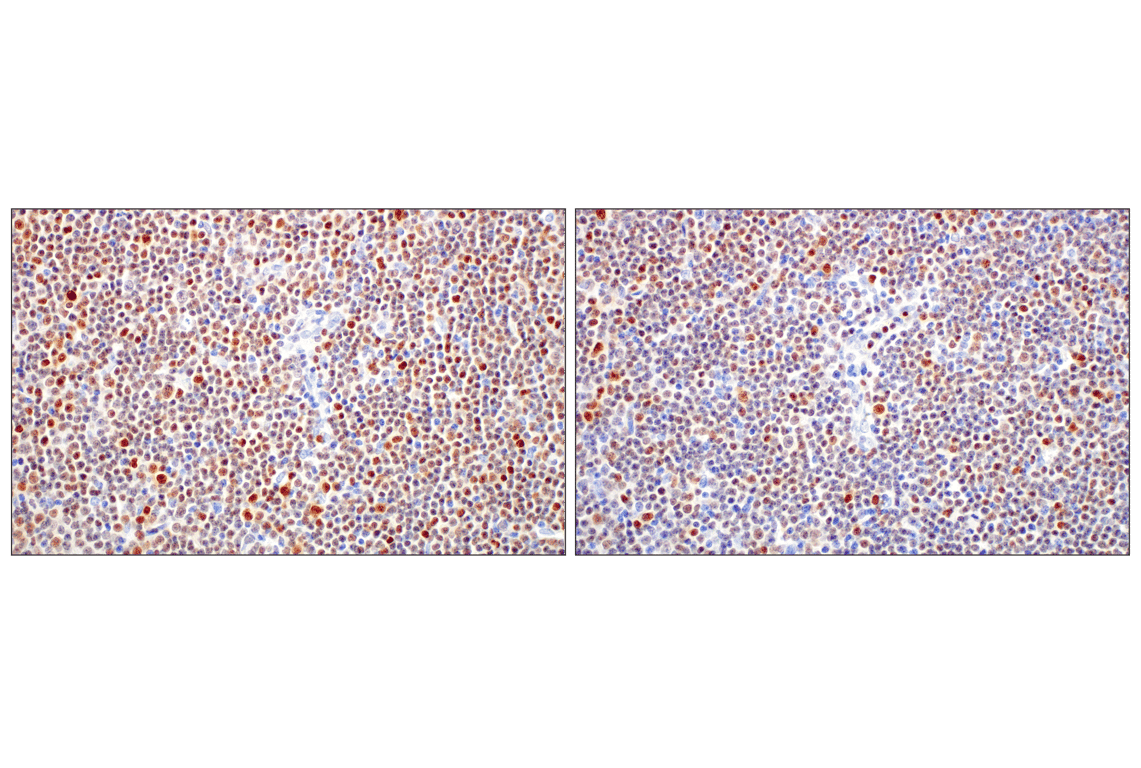 Immunohistochemistry Image 12: T-bet/TBX21 (E4I2K) Rabbit mAb