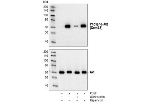 Western Blotting Image 2: Phospho-Akt (Ser473) (193H12) Rabbit mAb