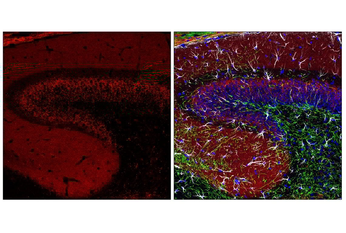 Immunofluorescence Image 1: VGLUT2 (E7P9K) Rabbit mAb
