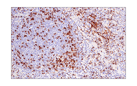 Immunohistochemistry Image 4: LAT (E3U6J) XP<sup>®</sup> Rabbit mAb (BSA and Azide Free)