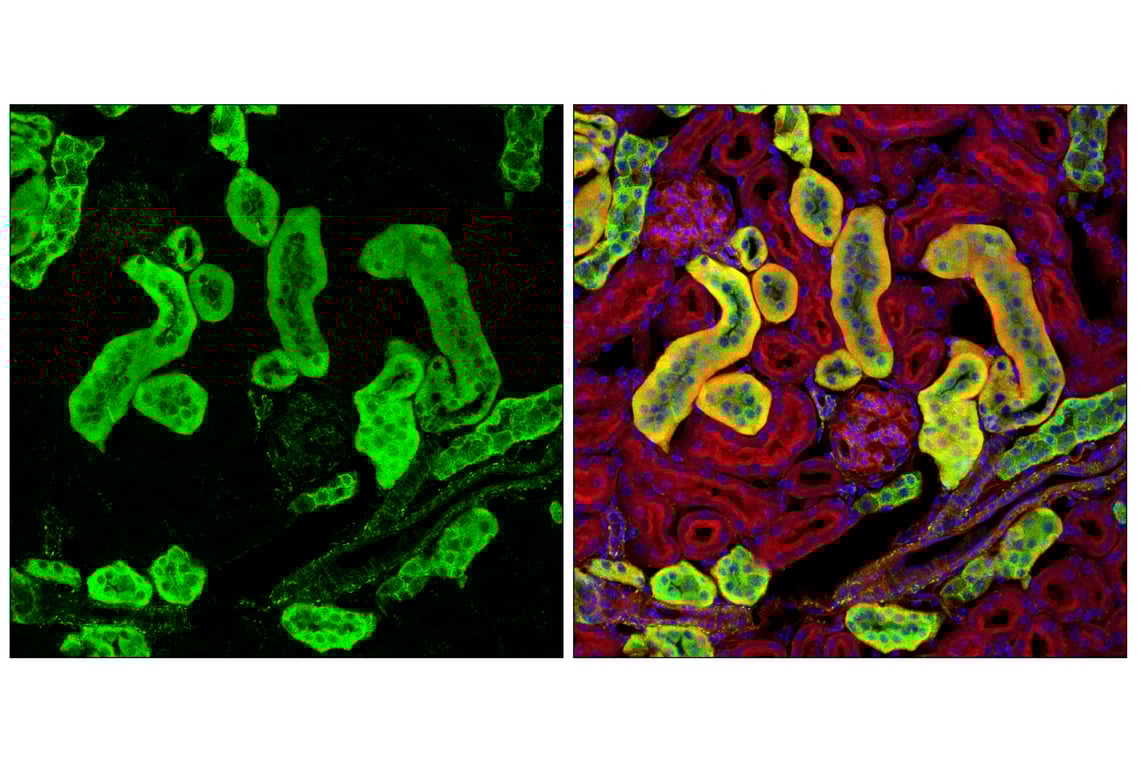 Immunofluorescence Image 3: Hexokinase I (C35C4) Rabbit mAb (BSA and Azide Free)