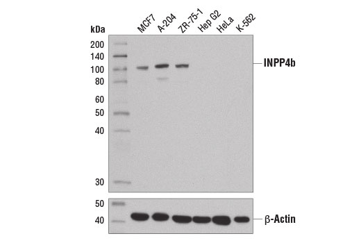 Western Blotting Image 1: INPP4b (D9K1B) XP<sup>®</sup> Rabbit mAb