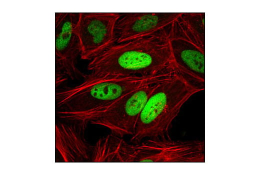 undefined Image 17: PhosphoPlus<sup>®</sup> c-Jun (Ser73) Antibody Duet