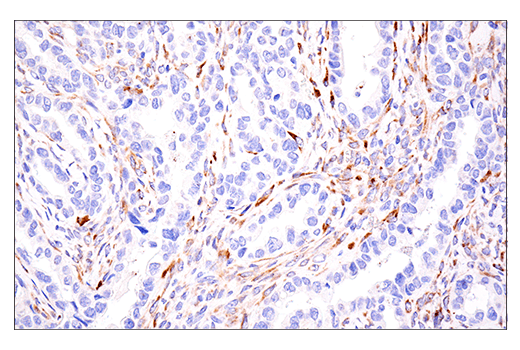 Immunohistochemistry Image 4: LOXL2 (E3P7Y) Rabbit mAb (BSA and Azide Free)