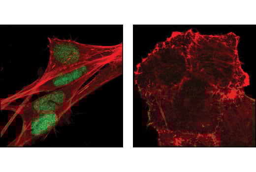 undefined Image 52: Epithelial-Mesenchymal Transition (EMT) IF Antibody Sampler Kit