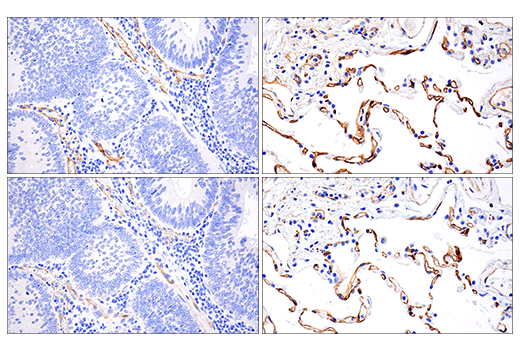 Immunohistochemistry Image 1: VE-Cadherin (E6N7A) Rabbit mAb (BSA and Azide Free)