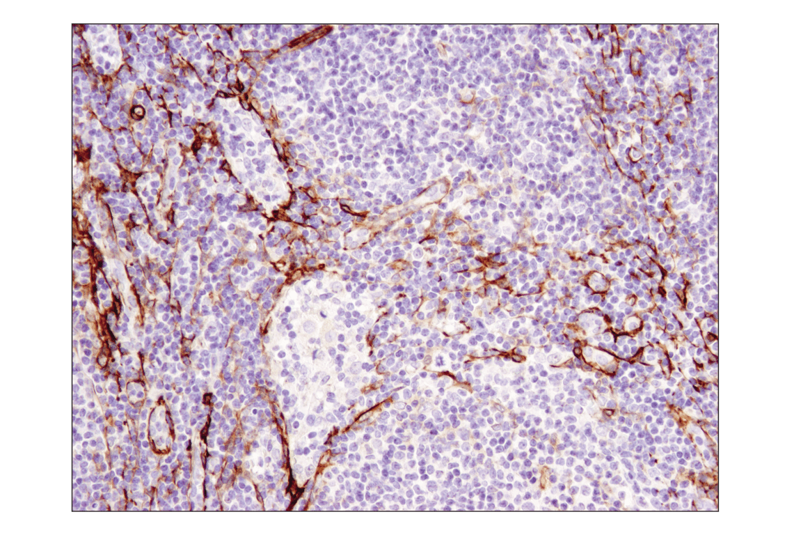 Immunohistochemistry Image 2: α-Smooth Muscle Actin (1A4) Mouse mAb (BSA and Azide Free)
