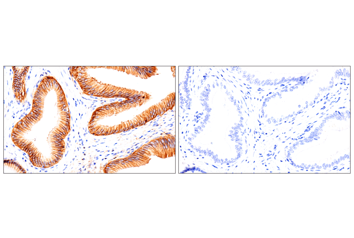 Immunohistochemistry Image 16: Syndecan 1 (E7F7T) Rabbit mAb