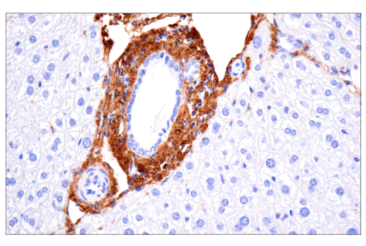 Immunohistochemistry Image 4: COL1A1 (E8F4L) XP<sup>®</sup> Rabbit mAb (BSA and Azide Free)