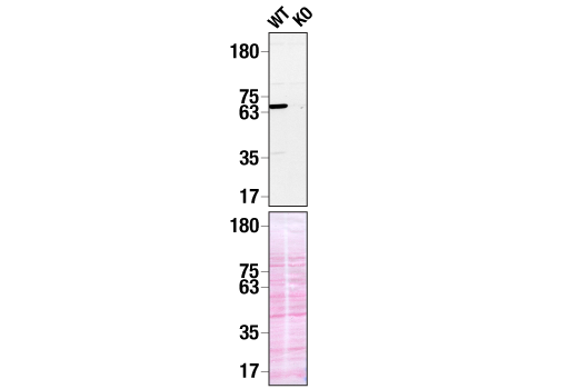 undefined Image 12: B Cell Signaling Antibody Sampler Kit II
