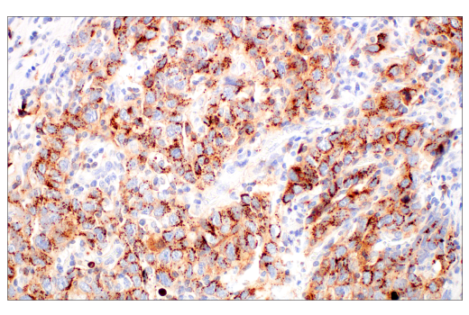 Immunohistochemistry Image 4: CD70 (E3Q1A) Rabbit mAb (BSA and Azide Free)