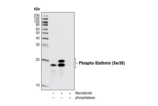 Western Blotting Image 1: Phospho-Stathmin (Ser38) (D19H10) Rabbit mAb