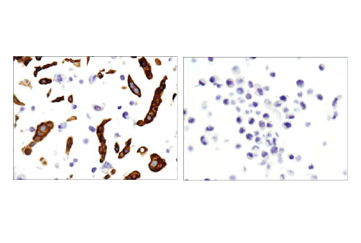 Immunohistochemistry Image 1: TRIM29/ATDC (E1L4E) Rabbit mAb