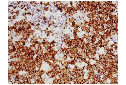 Immunohistochemistry Image 3: CD19 (Intracellular Domain) (D4V4B) XP<sup>®</sup> Rabbit mAb