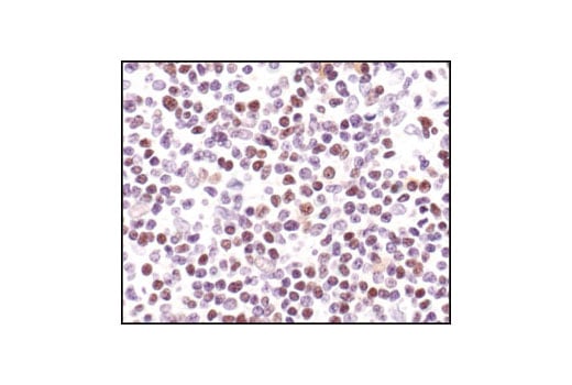 undefined Image 60: Cannabinoid Receptor 1 Downstream Signaling Antibody Sampler Kit