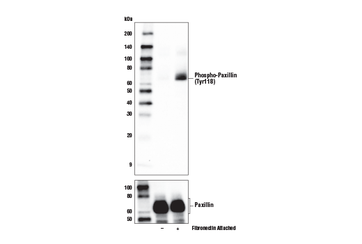 undefined Image 2: PhosphoPlus<sup>®</sup> Paxillin (Tyr118) Antibody Duet