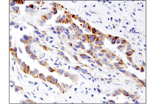 Immunohistochemistry Image 1: BNIP3 (D7U1T) Rabbit mAb