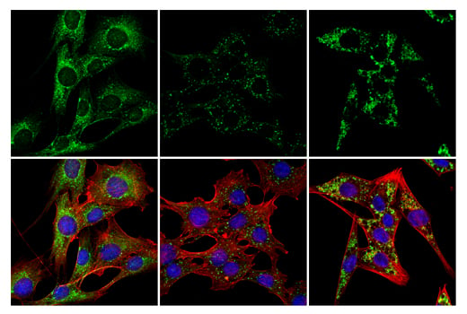 Immunofluorescence Image 3: LC3B (E7X4S) XP<sup>®</sup> Rabbit mAb