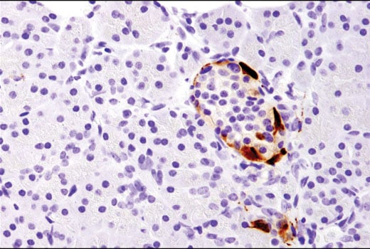 Immunohistochemistry Image 3: CART (D6M2M) Rabbit mAb