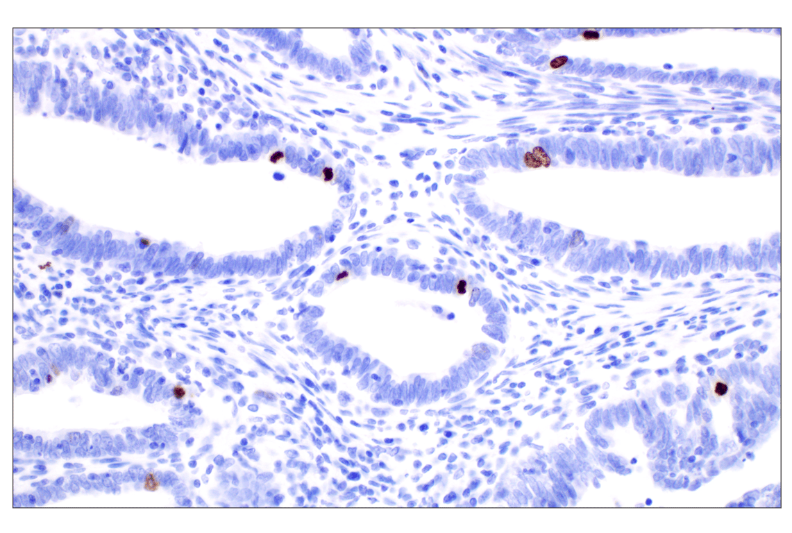 Immunohistochemistry Image 2: Phospho-Histone H3 (Ser10) (D7N8E) XP<sup>®</sup> Rabbit mAb (BSA and Azide Free)