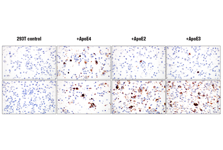 undefined Image 45: Late-Onset Alzheimer's Disease Risk Gene Antibody Sampler Kit