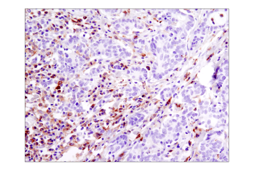 Immunohistochemistry Image 4: Btk (D3H5) Rabbit mAb (BSA and Azide Free)
