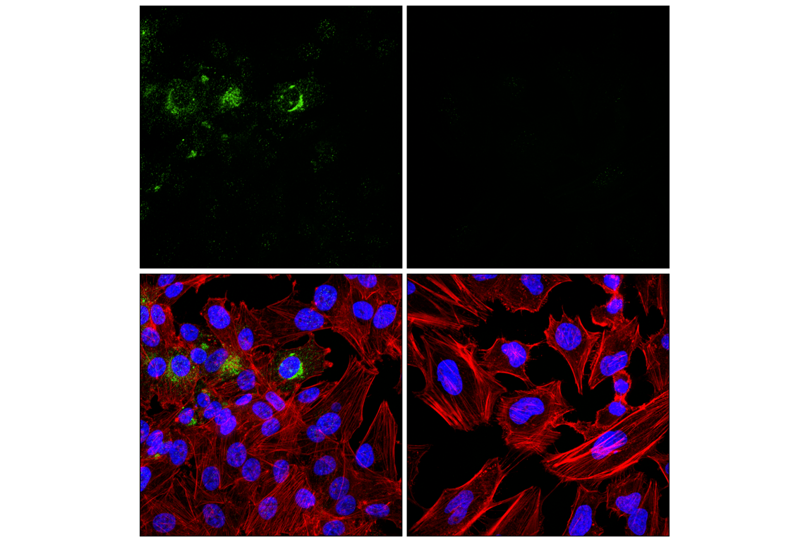 Immunofluorescence Image 1: PTN (F7T3F) Rabbit mAb