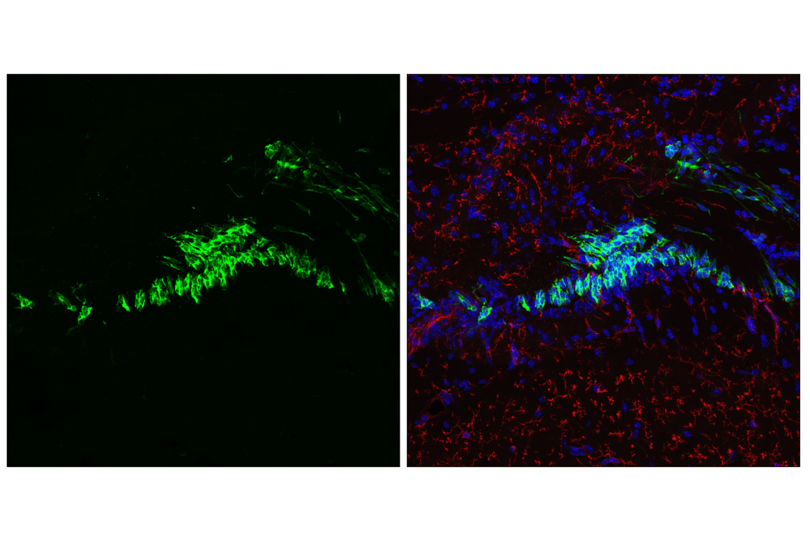 Immunofluorescence Image 2: Doublecortin (F6K9E) Rabbit mAb (BSA and Azide Free)