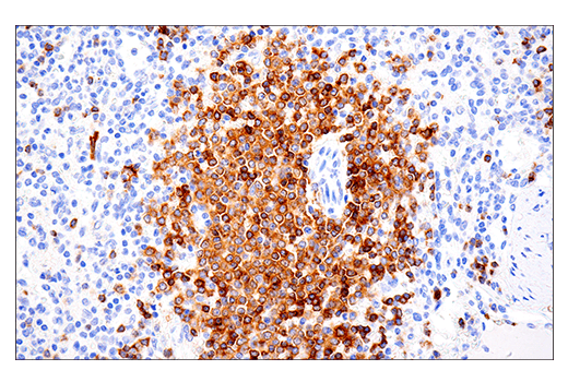 Immunohistochemistry Image 4: CD22 (E7L6Z) XP<sup>®</sup> Rabbit mAb (BSA and Azide Free)