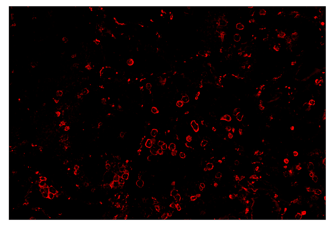 Immunohistochemistry Image 4: CD14 (D7A2T) & CO-0085-750 SignalStar<sup>™</sup> Oligo-Antibody Pair