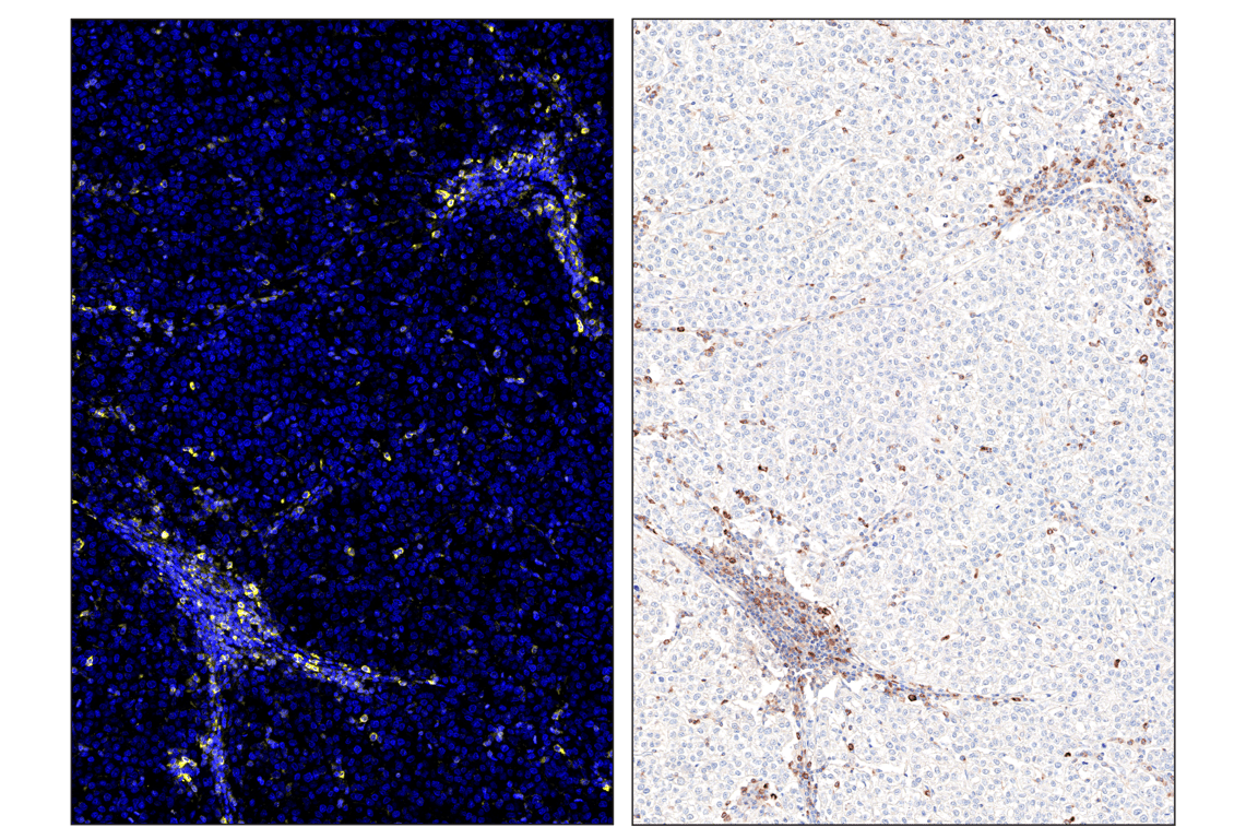 Immunohistochemistry Image 6: Phospho-SLP-76 (Ser376) (E3G9U) & CO-0018-750 SignalStar<sup>™</sup> Oligo-Antibody Pair