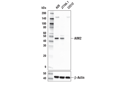 undefined Image 14: Mouse Reactive Inflammasome Antibody Sampler Kit