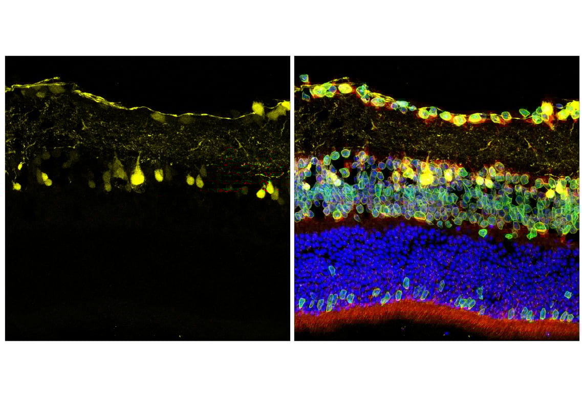 Immunofluorescence Image 2: Parvalbumin (E8N2U) XP<sup>®</sup> Rabbit mAb