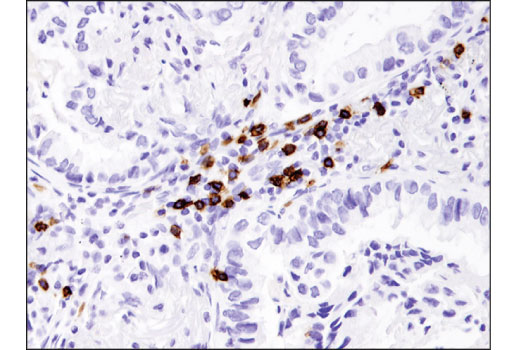 undefined Image 31: Human Exhausted CD8<sup>+</sup> T Cell IHC Antibody Sampler Kit