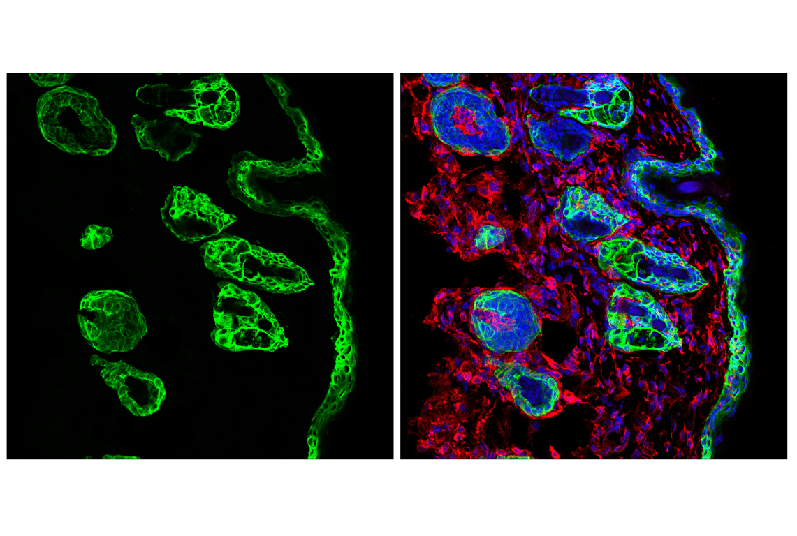 Immunofluorescence Image 1: Keratin 14 (E7W6V) Rabbit mAb