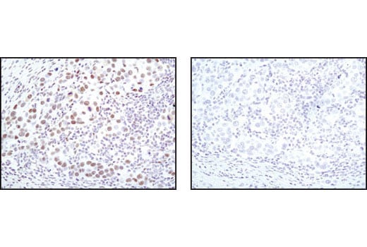 Immunohistochemistry Image 1: CDK9 (C12F7) Rabbit mAb (BSA and Azide Free)