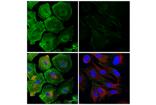 Immunofluorescence Image 1: Myosin IIa (E7Y9O) Rabbit mAb