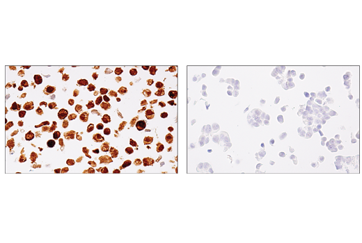 Immunohistochemistry Image 1: MAGE-A4 (E7O1U) XP<sup>®</sup> Rabbit mAb (BSA and Azide Free)