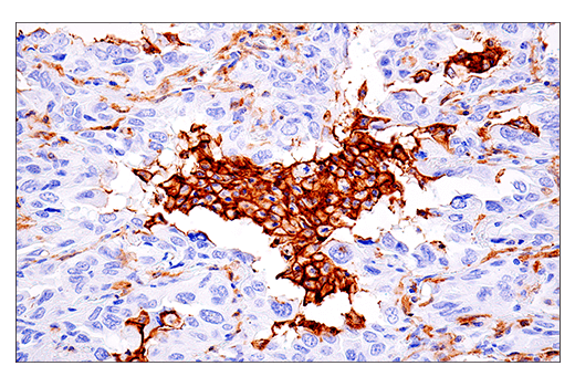 Immunohistochemistry Image 6: LAIR-1 (E7X6I) XP<sup>®</sup> Rabbit mAb (BSA and Azide Free)