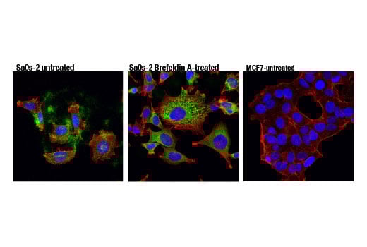 undefined Image 13: YAP/TAZ Transcriptional Targets Antibody Sampler Kit