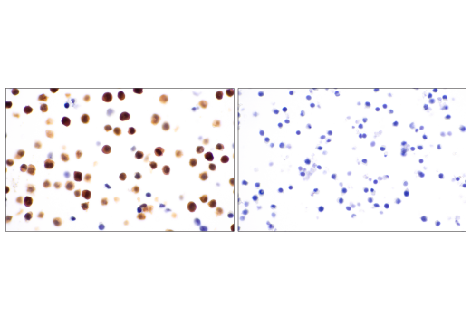 Immunohistochemistry Image 1: ASC/TMS1 (D2W8U) Rabbit mAb