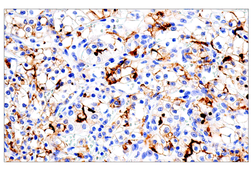 undefined Image 27: SARS-CoV-2 Virus-Host Interaction Antibody Sampler Kit