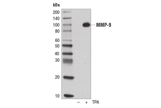 ECM Profiling Antibody Sampler Kit: Image 1