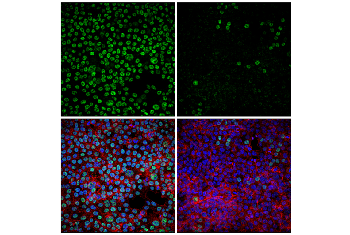 Immunofluorescence Image 1: USP22 (F4M4V) Rabbit mAb
