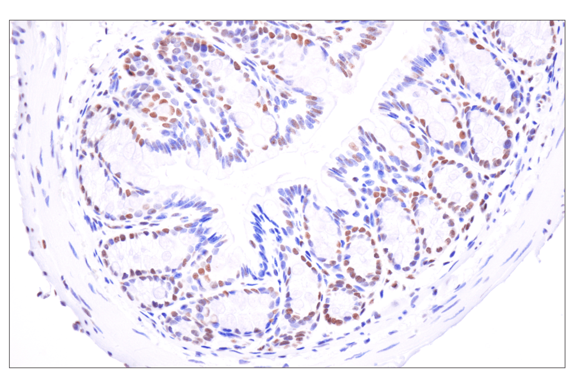 Immunohistochemistry Image 10: Acetyl-Histone H4 (Lys16) (E2B8W) Rabbit mAb