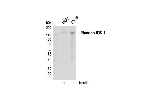 Western Blotting Image 1: Phospho-IRS-1 (Ser302) (34C7) Rabbit mAb