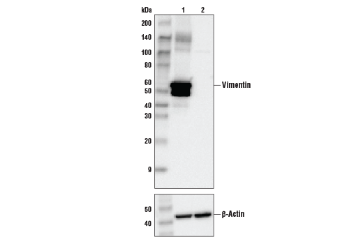 undefined Image 17: Cell Fractionation Antibody Sampler Kit