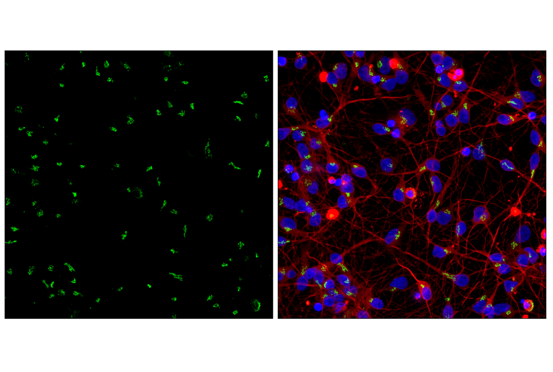 Immunofluorescence Image 2: GM130 (D6B1) XP<sup>®</sup> Rabbit mAb