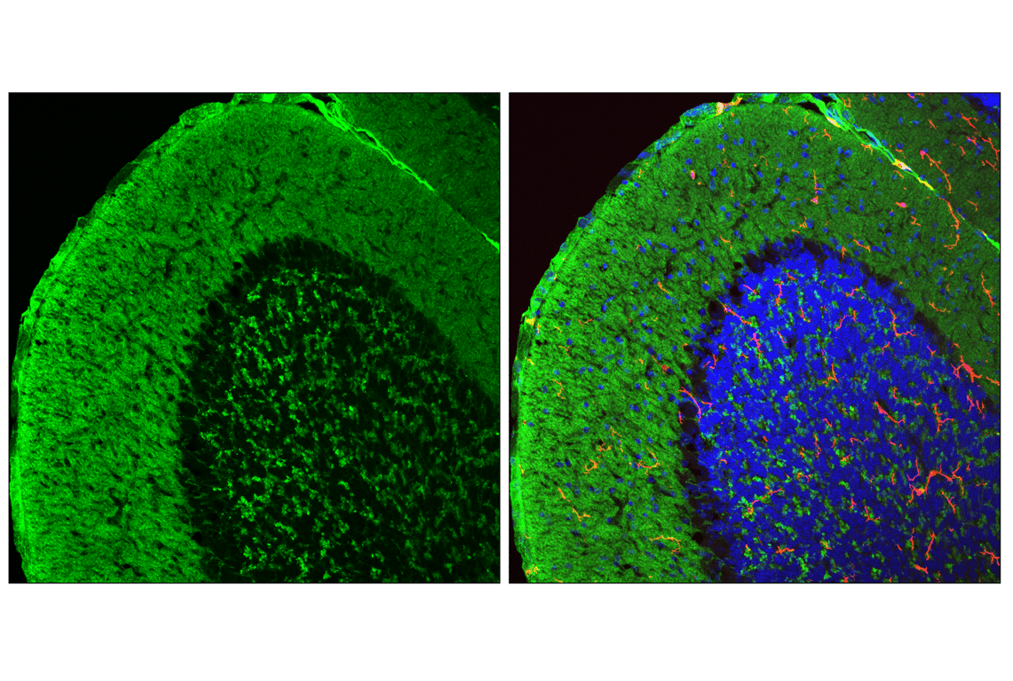 Immunofluorescence Image 1: VGLUT1 (E9D2B) Mouse mAb